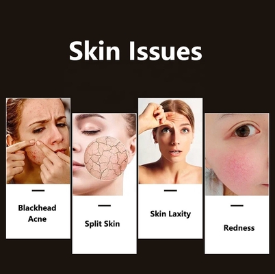 Compact Skin Led Facial Light Therapy pour l' amélioration de l' acné de qualité professionnelle