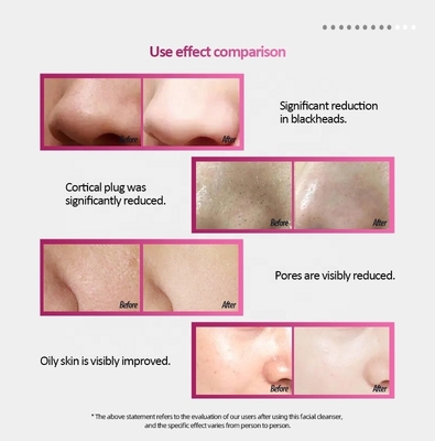130*56*28 pinceau de lavage du visage en silicone avec charge sans fil et massage imperméable à l'eau IPX6
